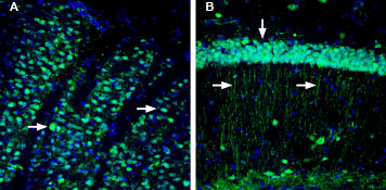 Expression of CD73 in mouse striatum and hippocampus.