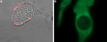 Expression of TRPM8 in LNCaP prostate carcinoma cell line