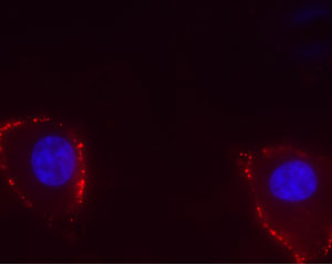 Expression of TRPV4 in human U-87 cells