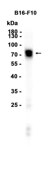 AMRe87645