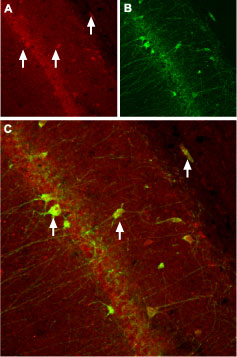 Expression of CACNB3 (Ca V β3) in rat hippocampus