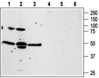 Western blot analysis of human prostate carcinoma PC3 (lanes 1 and 4), and Human LNCaP prostate carcinoma (lanes 2 and 5), and human T cell leukemia Jurkat (lanes 3 and 6) cell lines: