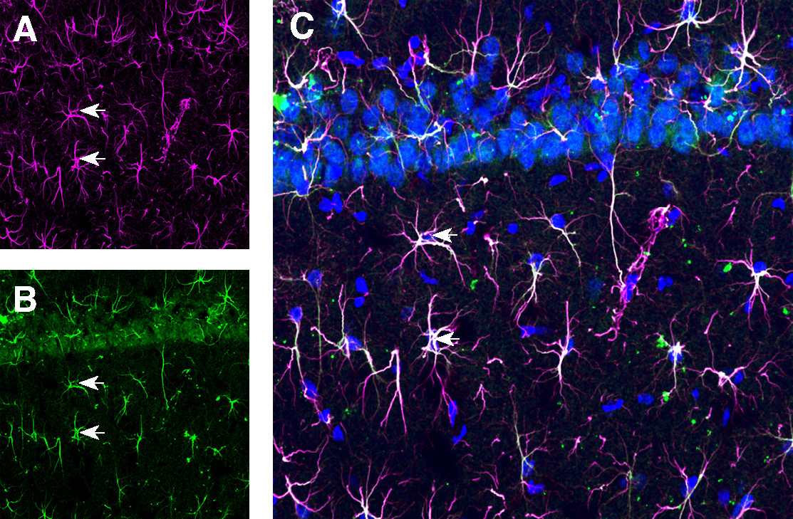 Expression of GFAP and TSH Receptor in rat hippocampus CA1 region.