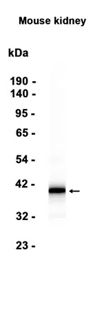AMRe87167
