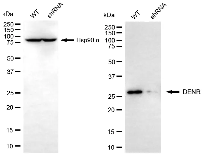 KVAb01454