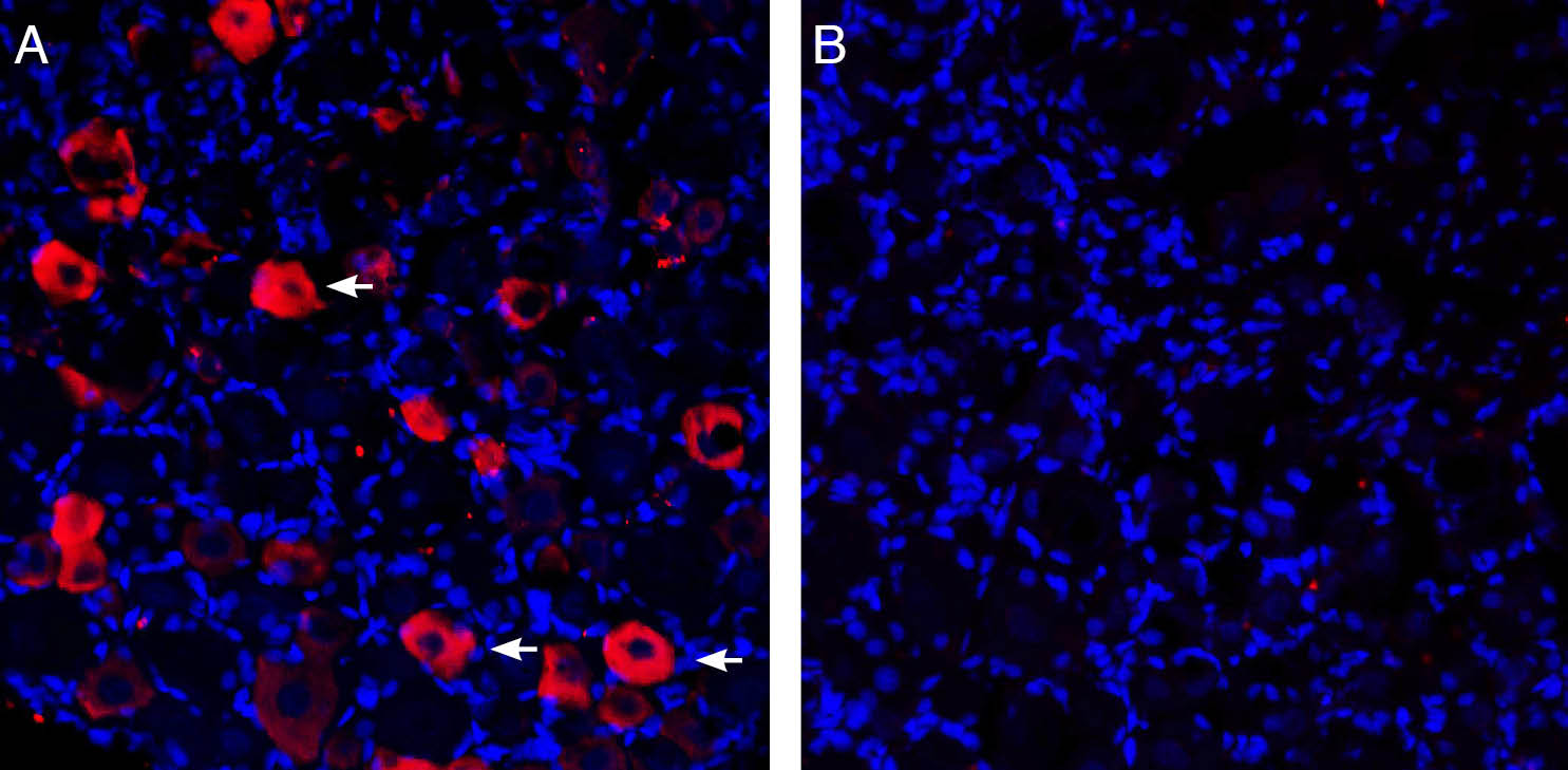 Expression of P2X3 in rat dorsal root ganglion.