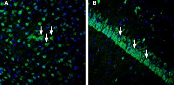Expression of IGF1R in rat cortex and hippocampus