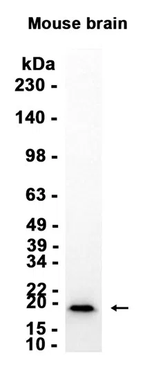 AMRe87215