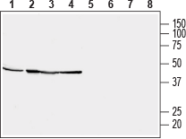 Western blot analysis of human brain neuroblastoma SH-SY5Y (lanes 1 and 5), human prostate carcinoma DU 145 (lanes 2 and 6), human pancreatic carcinoma PANC-1 (lanes 3 and 7) and human acute lymphoblastic leukemia MOLT-4 (lanes 4 and 8):