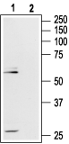 Western blot analysis of rat hippocampus lysate: