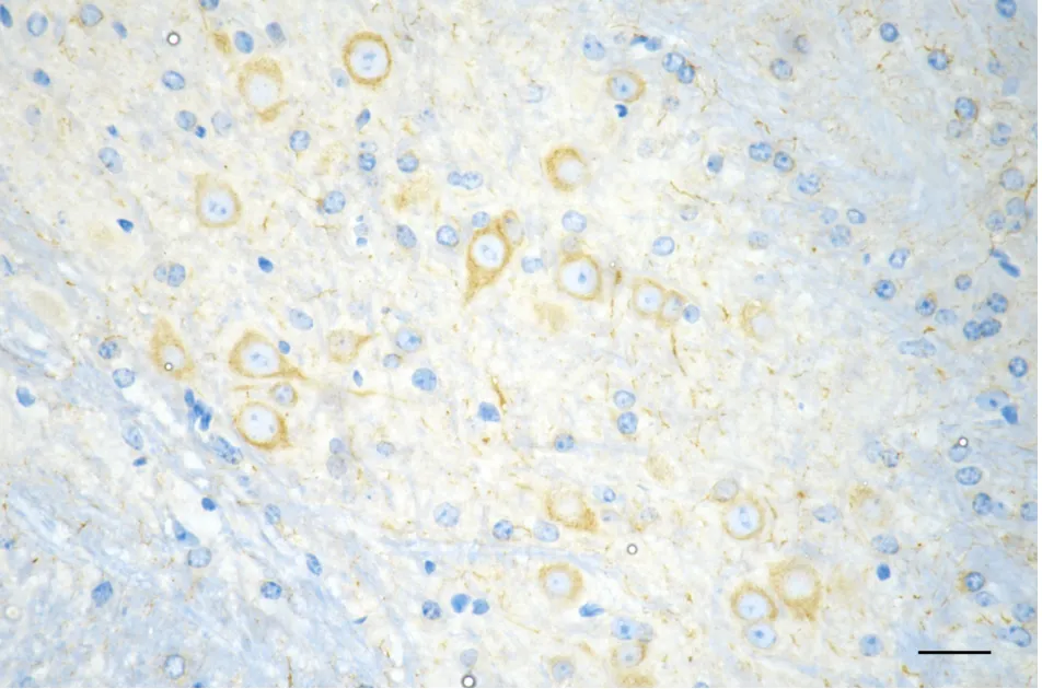 KVAb01095