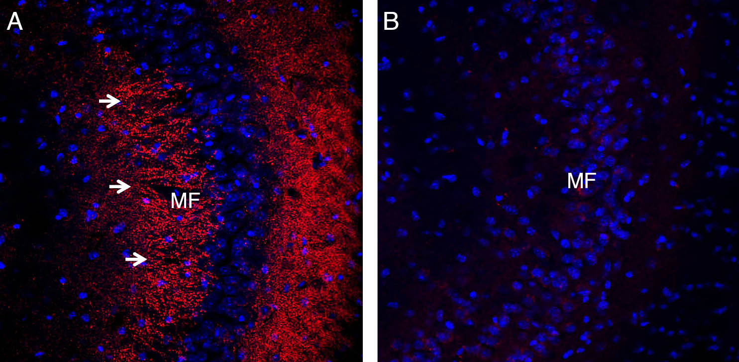 Expression of Synaptophysin in mouse hippocampus.