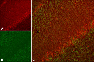 Expression of K V 11.3 (erg3) in rat cerebellum