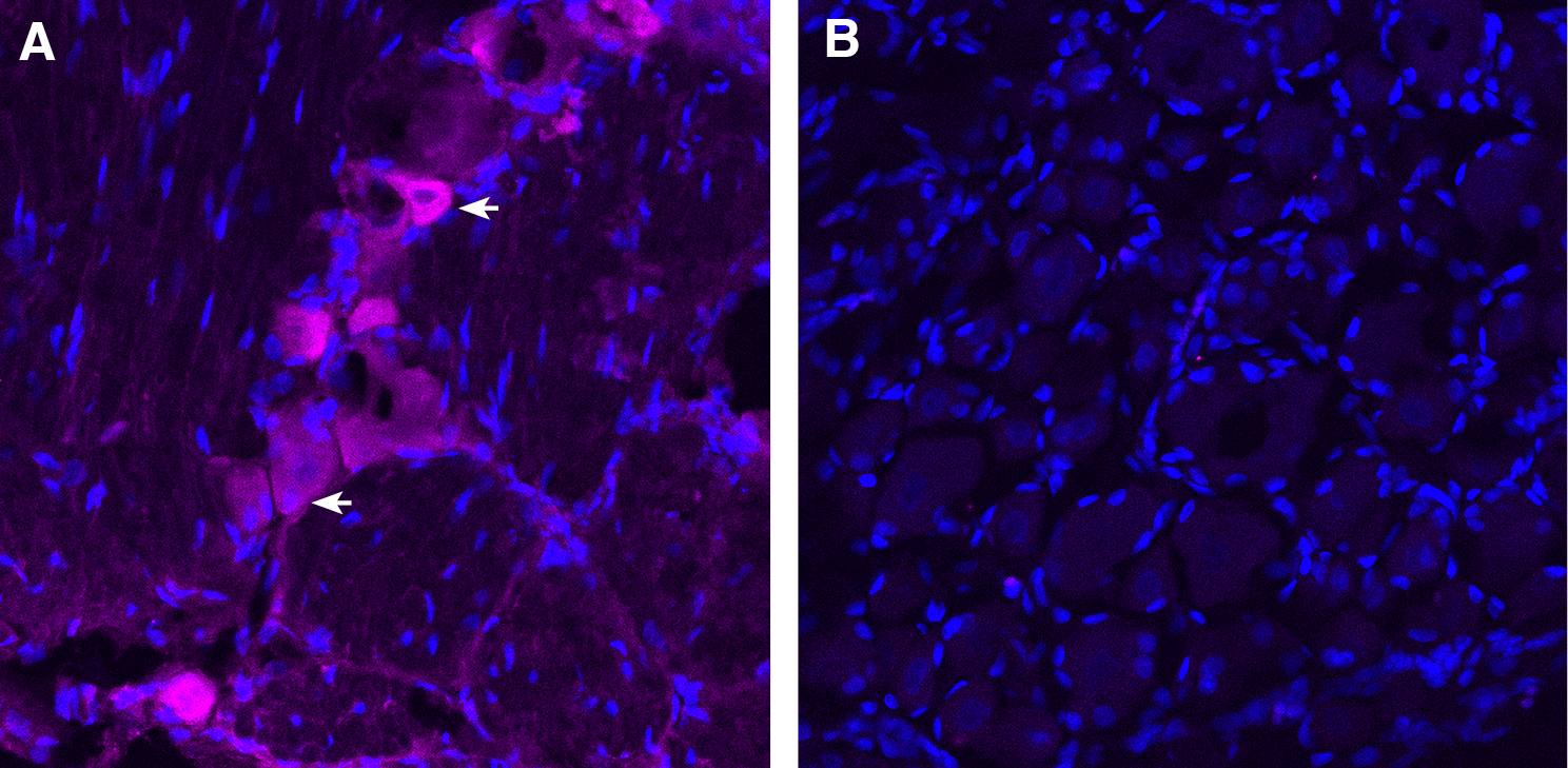 TRPV1 in rat dorsal root ganglion (DRG)