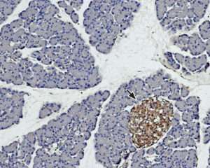 Expression of syntaxin 4 in rat pancreas