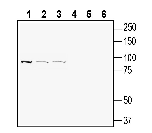 Western blot analysis of rat brain membranes (lanes 1 and 4), mouse Neuro-2a neuroblastoma cell line lysate (lanes 2 and 5) and human SH-SY5Y neuroblastoma cell line lysate (lanes 3 and 6):
