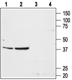 Western blot analysis of rat liver (lanes 1 and 3) and rat kidney (lanes 2 and 4) membranes: