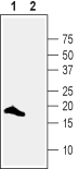 Western blot analysis of rat brain lysates: