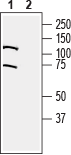 Western blot analysis of rat lung membranes: