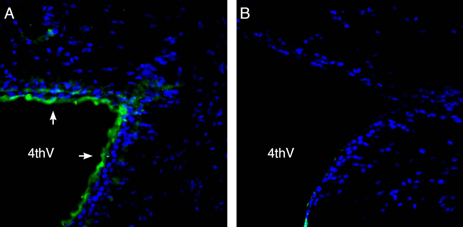 Expression of Parkin in rat brain 4 th ventricle.