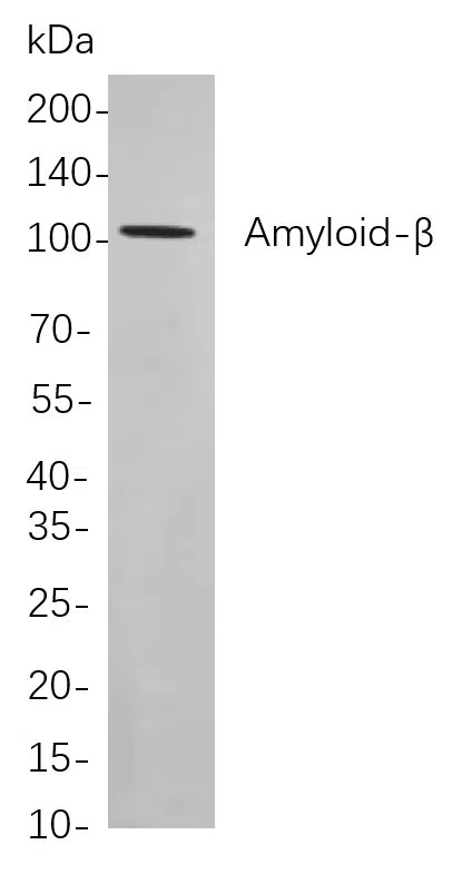 AMRe21375