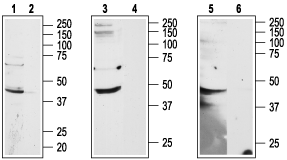 Western blot analysis of human HL-60 promyelocytic leukemia (lanes 1 and 2) cell line, rat brain (lanes 3 and 4) and mouse brain (lanes 5 and 6) lysates: