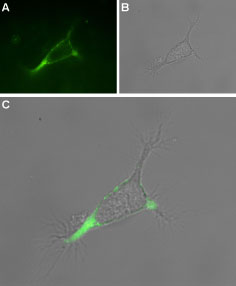 Expression of TRPV1 in rat PC12 cells