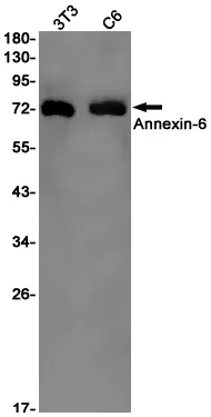 AMRe01654