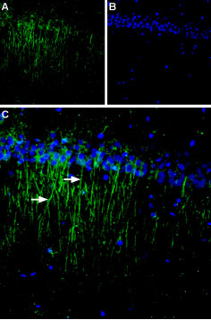 Expression of CaSR in rat brain