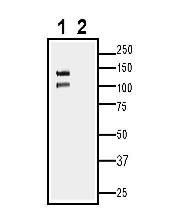 Western blot analysis of rat heart membranes: