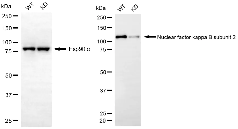 KVAb01395