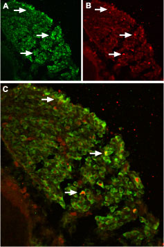 Expression of TRPV2 in mouse DRG