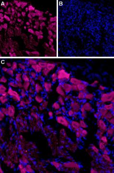 Expression of TRPV3 in rat DRG