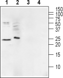 Western blot analysis of mouse brain membranes (lanes 1 and 3) and human Malme-3M melanoma cell lysate (lanes 2 and 4):