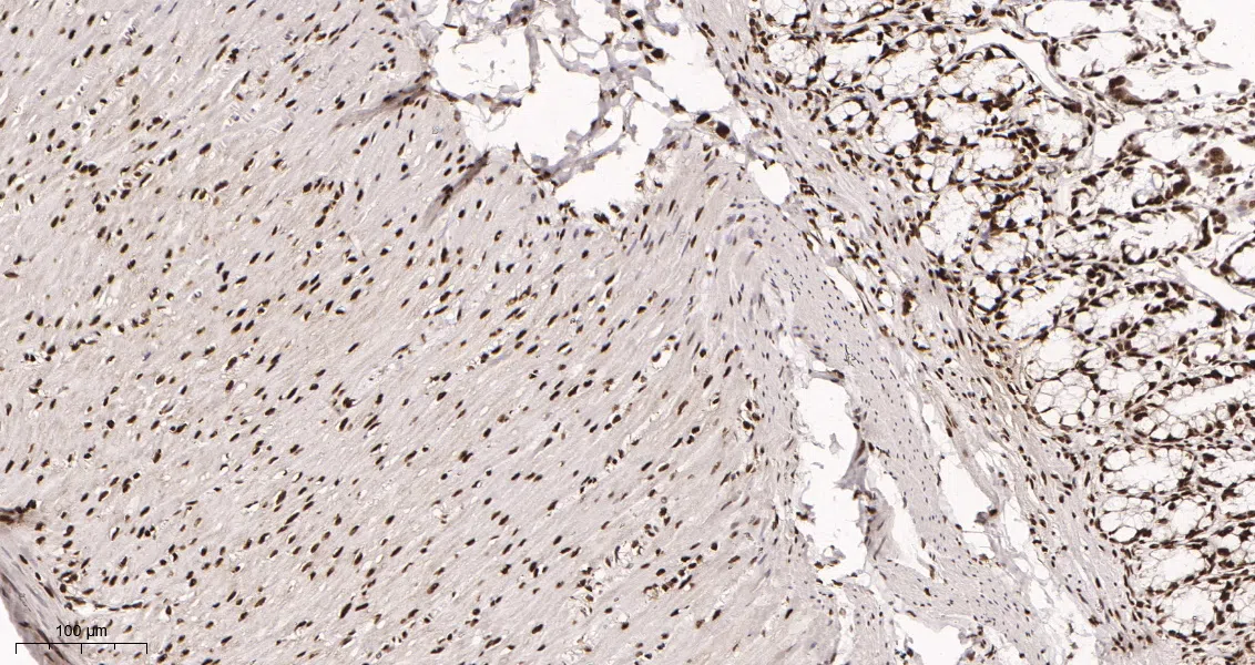 AMRe21580