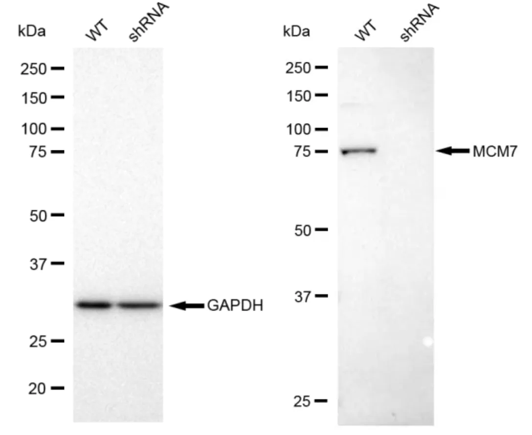 KVAb00262
