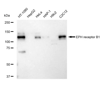 KVAb01091