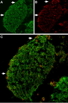 Expression of TRPV2 in mouse DRG