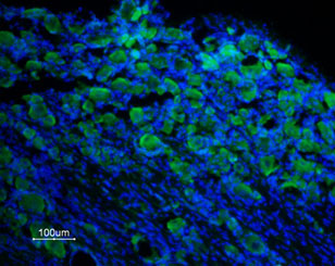 Expression of TRPM8 in rat DRG