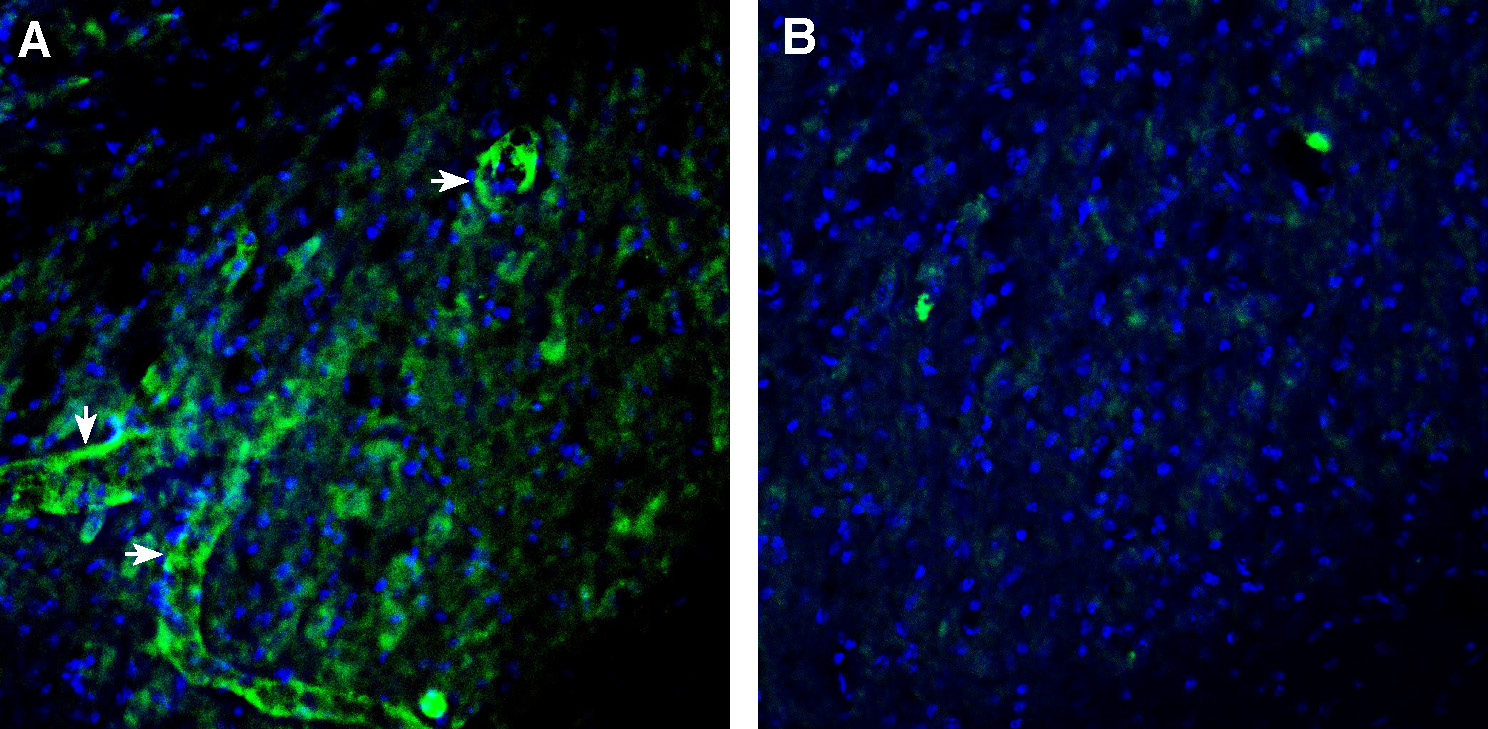Expression of CCR7 in mouse deep cerebellar nuclei.
