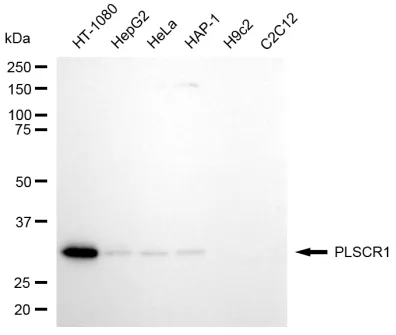 KVAb00457