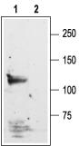 Western blot analysis of rat brain lysate: