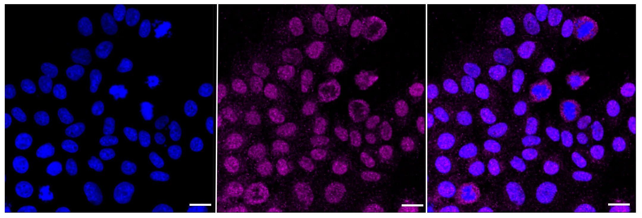 KVAb01045