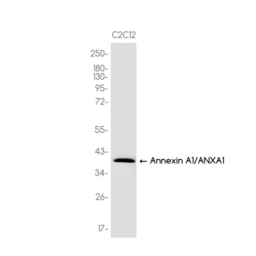 AMRe87135
