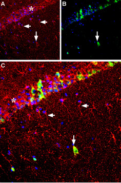 Expression of GDNF in rat hippocampus