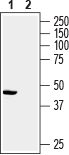 Western blot analysis of rat heart membrane: