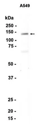 AMRe87169