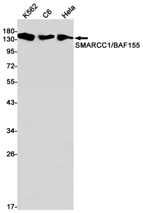 AMRe02615
