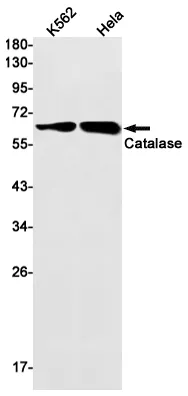 AMRe04060