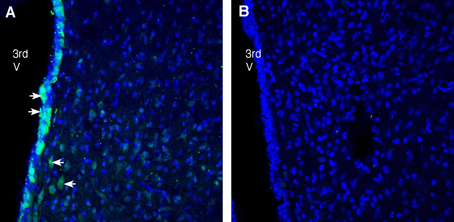 Expression of progranulin in rat hypothalamus.